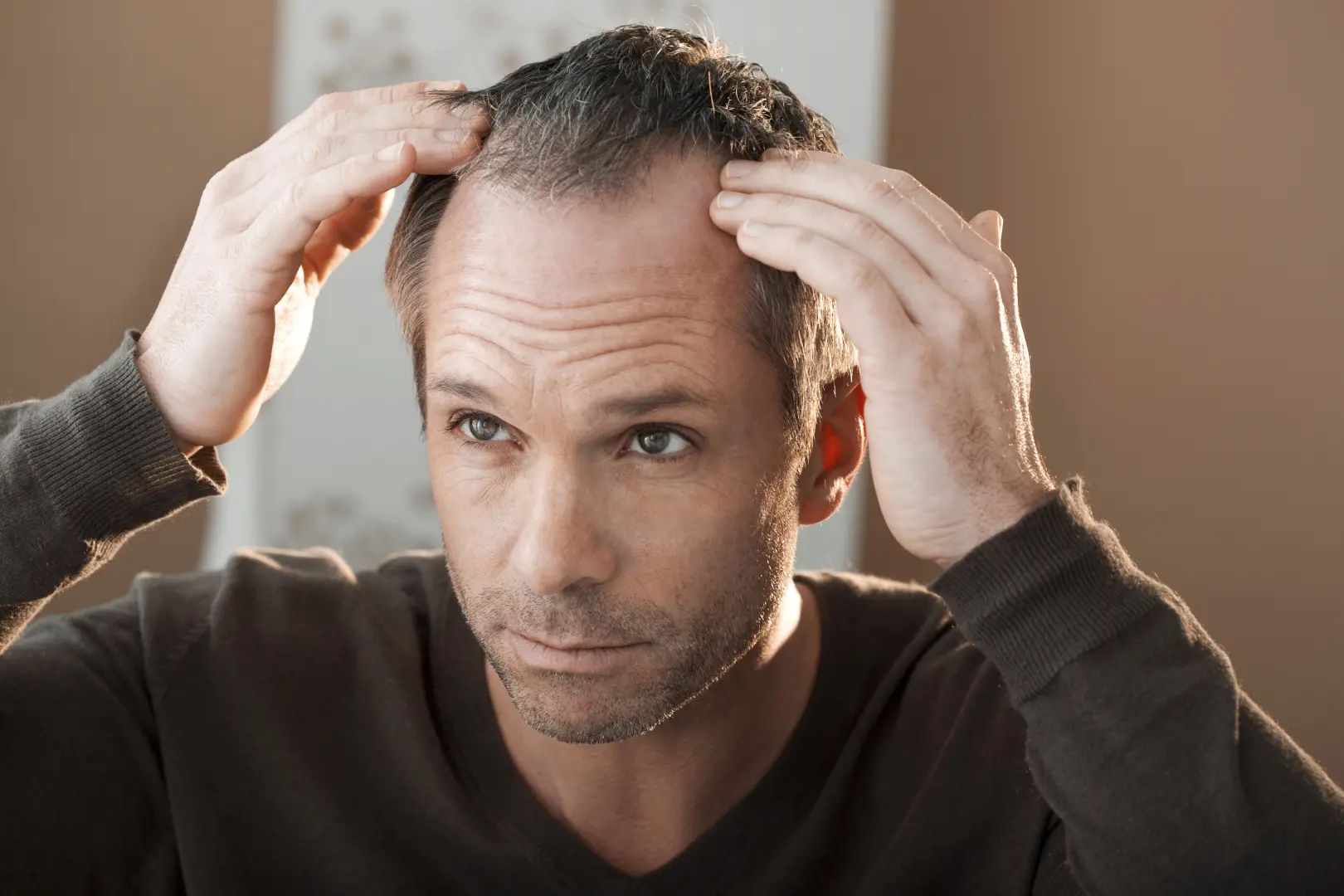 Hair Loss