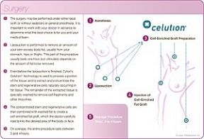 Cell Enriched Reconstructive Surgery
