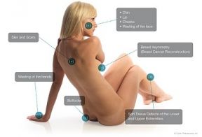 Cell Enriched Procedures